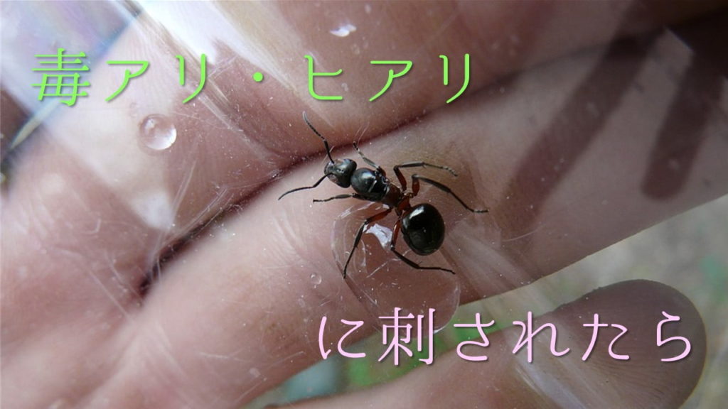 蟻に噛まれたら アリは噛んで刺す チクチク痛みの処置 ネットdeカガク