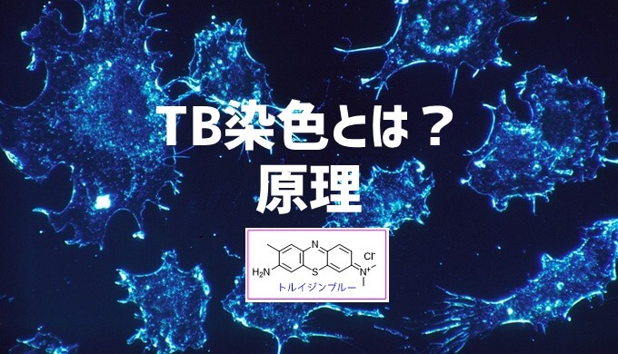 トルイジンブルー染色 TB染色の原理とは